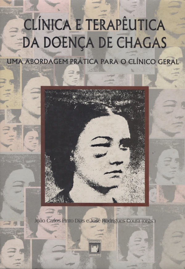 Clínica e terapêutica da doença de Chagas: uma abordagem prática para o clínico geral